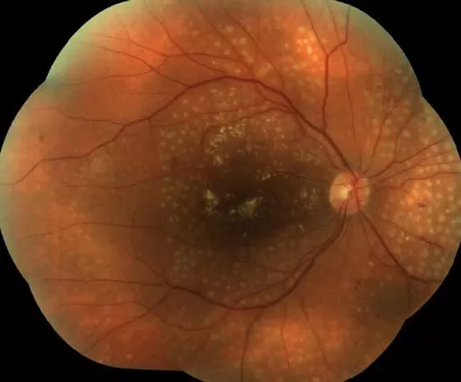 Das Modell in der Praxis anhand eines realen Fotos lernen